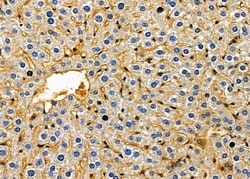 Invitrogen CRABP1 Polyclonal Antibody 100 &mu;L; Unconjugated:Antibodies,