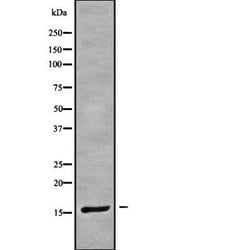 Invitrogen CRABP1 Polyclonal Antibody 100 &mu;L; Unconjugated:Antibodies,
