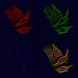 Invitrogen CCP110 Polyclonal Antibody 100 &mu;L; Unconjugated:Antibodies,
