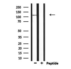 Invitrogen CCP110 Polyclonal Antibody 100 &mu;L; Unconjugated:Antibodies,