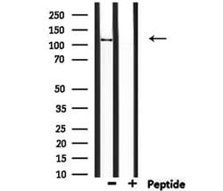 Invitrogen CCP110 Polyclonal Antibody 100 &mu;L; Unconjugated:Antibodies,