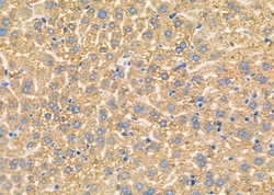Invitrogen CCP110 Polyclonal Antibody 100 &mu;L; Unconjugated:Antibodies,