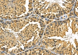 Invitrogen CCP110 Polyclonal Antibody 100 &mu;L; Unconjugated:Antibodies,