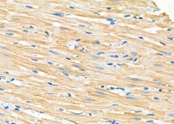 Invitrogen CCP110 Polyclonal Antibody 100 &mu;L; Unconjugated:Antibodies,