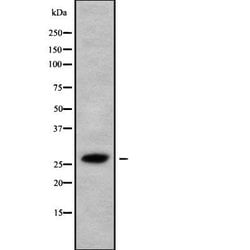 Invitrogen HAUS2 Polyclonal Antibody 100 &mu;L | Buy Online | Invitrogen&trade; | Fisher Scientific