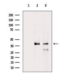 Invitrogen CEP41 Polyclonal Antibody 100 &mu;L; Unconjugated:Antibodies,