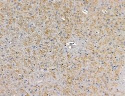 Invitrogen CEP63 Polyclonal Antibody 100 &mu;L; Unconjugated:Antibodies,