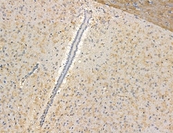 Invitrogen CEP63 Polyclonal Antibody 100 &mu;L; Unconjugated:Antibodies,