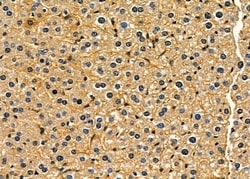 Invitrogen CEP68 Polyclonal Antibody 100 &mu;L; Unconjugated:Antibodies,