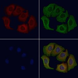 Invitrogen CEP72 Polyclonal Antibody 100 &mu;L; Unconjugated:Antibodies,