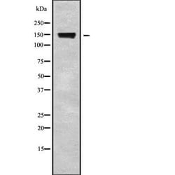 Invitrogen CSPP1 Polyclonal Antibody 100 &mu;L; Unconjugated:Antibodies,