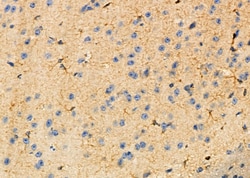 Invitrogen CKLF Polyclonal Antibody 100 &mu;L | Buy Online | Invitrogen&trade; | Fisher Scientific