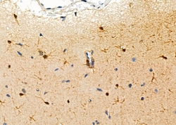 Invitrogen CKLF Polyclonal Antibody 100 &mu;L | Buy Online | Invitrogen&trade; | Fisher Scientific