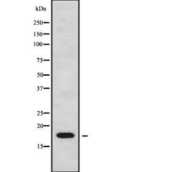 Invitrogen CKLF Polyclonal Antibody 100 &mu;L | Buy Online | Invitrogen&trade; | Fisher Scientific