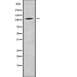 Invitrogen CLCN1 Polyclonal Antibody 100 &mu;L | Buy Online | Invitrogen&trade; | Fisher Scientific