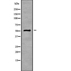 Invitrogen CBX2 Polyclonal Antibody 100 &mu;L | Buy Online | Invitrogen&trade; | Fisher Scientific