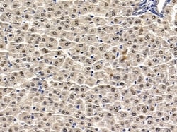 Invitrogen CHD6 Polyclonal Antibody 100 &mu;L; Unconjugated:Antibodies,
