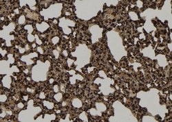 Invitrogen KIF4B Polyclonal Antibody 100 &mu;L; Unconjugated:Antibodies,