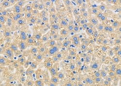 Invitrogen CMTM8 Polyclonal Antibody 100 &mu;L | Buy Online | Invitrogen&trade; | Fisher Scientific