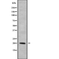 Invitrogen CMTM8 Polyclonal Antibody 100 &mu;L | Buy Online | Invitrogen&trade; | Fisher Scientific