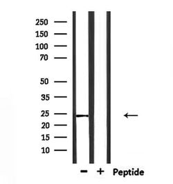 Invitrogen Claudin 20 Polyclonal Antibody 100 &mu;L; Unconjugated:Antibodies,