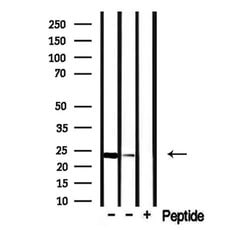Invitrogen Claudin 22/24 Polyclonal Antibody 100 &mu;L; Unconjugated:Antibodies,