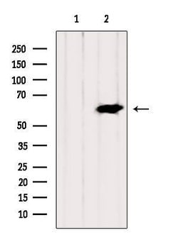 Invitrogen CPSF6 Polyclonal Antibody 100 &mu;L | Buy Online | Invitrogen&trade; | Fisher Scientific
