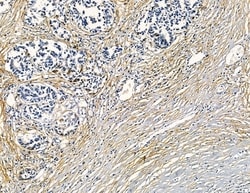 Invitrogen Factor XI Polyclonal Antibody 100 &mu;L; Unconjugated:Antibodies,