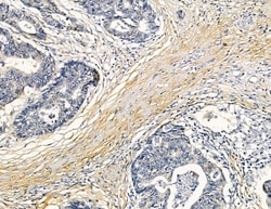 Invitrogen Factor XI Polyclonal Antibody 100 &mu;L; Unconjugated:Antibodies,