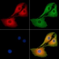 Invitrogen Factor XIII B Polyclonal Antibody 100 &mu;L; Unconjugated:Antibodies,