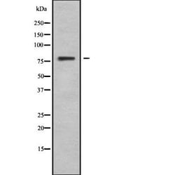 Invitrogen CNGA3 Polyclonal Antibody 100 &mu;L; Unconjugated:Antibodies,