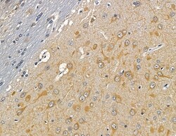 Invitrogen CNGB3 Polyclonal Antibody 100 &mu;L; Unconjugated:Antibodies,