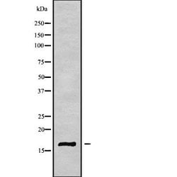 Invitrogen Cystatin M Polyclonal Antibody 100 &mu;L; Unconjugated:Antistoffer