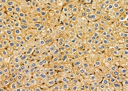 Invitrogen DYNC1I2 Polyclonal Antibody 100 &mu;L; Unconjugated:Antibodies,