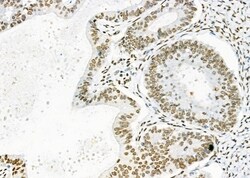 Invitrogen DHRS1 Polyclonal Antibody 100 &mu;L; Unconjugated:Antibodies,