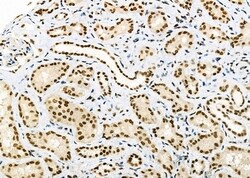 Invitrogen DHRS1 Polyclonal Antibody 100 &mu;L; Unconjugated:Antibodies,