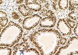 Invitrogen DHRS1 Polyclonal Antibody 100 &mu;L; Unconjugated:Antibodies,