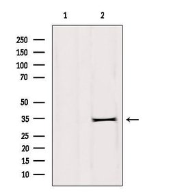 Invitrogen DHRS1 Polyclonal Antibody 100 &mu;L; Unconjugated:Antibodies,