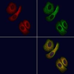 Invitrogen DGAT2 Polyclonal Antibody 100 &mu;L; Unconjugated:Antibodies,