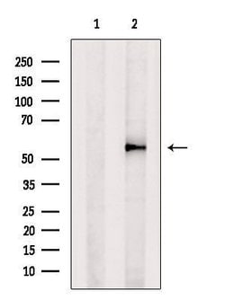 Invitrogen DGAT2 Polyclonal Antibody 100 &mu;L; Unconjugated:Antibodies,