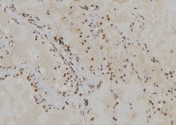 Invitrogen POLA2 Polyclonal Antibody 100 &mu;L | Buy Online | Invitrogen&trade; | Fisher Scientific