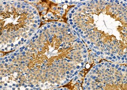 Invitrogen POLG Polyclonal Antibody 100 &mu;L; Unconjugated:Antibodies,