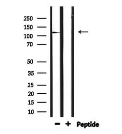 IGHMBP2 Polyclonal Antibody:Antibodies, Polyclonal