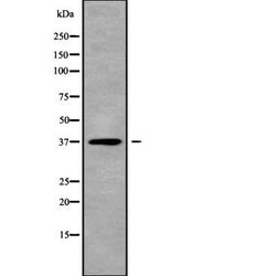 Invitrogen TWISTNB Polyclonal Antibody 100 &mu;L; Unconjugated:Antibodies,