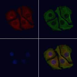 Invitrogen Dynactin 4 Polyclonal Antibody 100 &mu;L; Unconjugated:Antibodies,