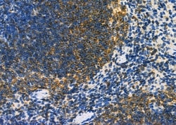 Invitrogen DYNLRB1 Polyclonal Antibody 100 &mu;L; Unconjugated:Antibodies,