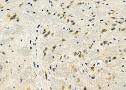 Invitrogen DYNLRB1 Polyclonal Antibody 100 &mu;L; Unconjugated:Antibodies,