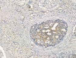 Invitrogen DYNLRB2 Polyclonal Antibody 100 &mu;L; Unconjugated:Antibodies,