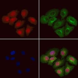 Invitrogen DYNLT3 Polyclonal Antibody 100 &mu;L | Buy Online | Invitrogen&trade; | Fisher Scientific