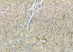 Invitrogen DYNLT3 Polyclonal Antibody 100 &mu;L | Buy Online | Invitrogen&trade; | Fisher Scientific